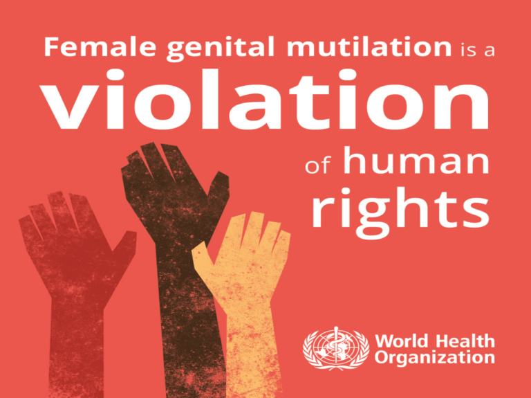 FGM